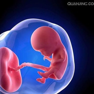 抗hcg抗体阳性影不影响做试管婴儿要孩子？